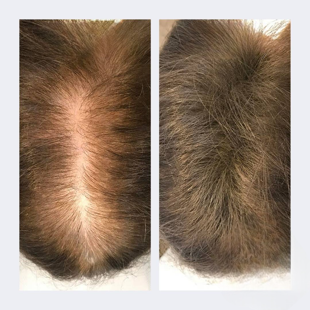 Sérum pousse de cheveux